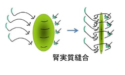 ロボットを用いた腎縫合