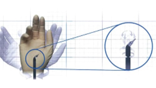 ロボット支援手術02